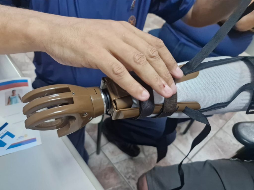 Jovem de 26 anos recebe mão biônica em cerimônia na Casa da Cultura Juquinha Taques em Itararé (SP)
